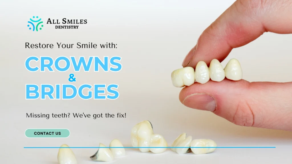 All Smiles-Crowns & Bridges