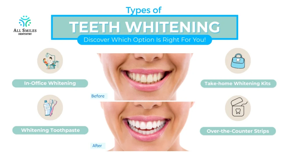 All Smiles-Types of teeth